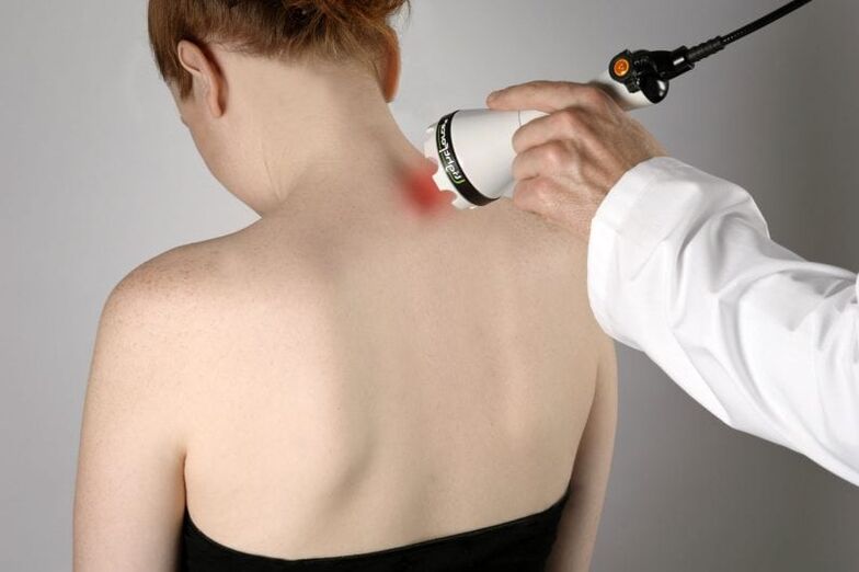 Kadınlarda servikal osteokondrozun lazer tedavisi