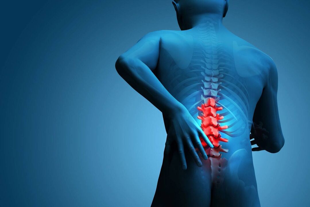 lomber osteokondroz ile ağrı